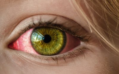 Prevent Pink Eye – Students